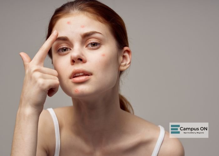 salud de la piel salud de la piel