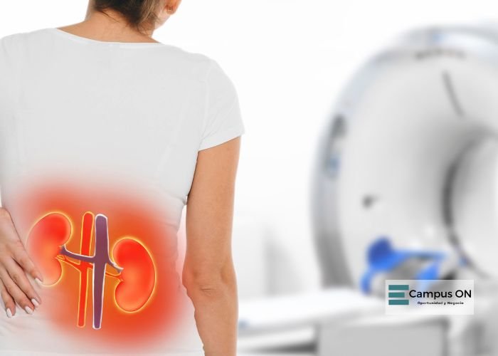 la enfermedad del riñon la enfermedad del riñon